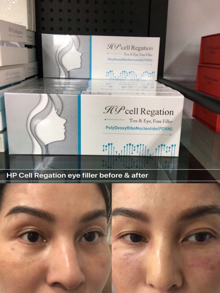 hpcell regation eye filler for dark circle saggy under eye hollow