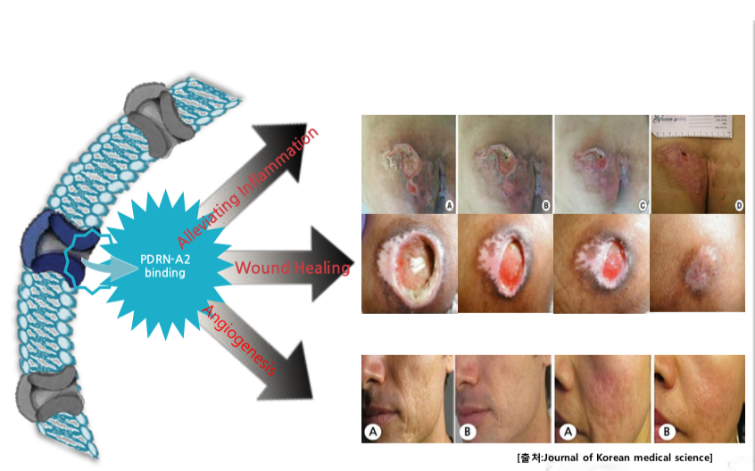 pdrn tissue regeneration wound healing