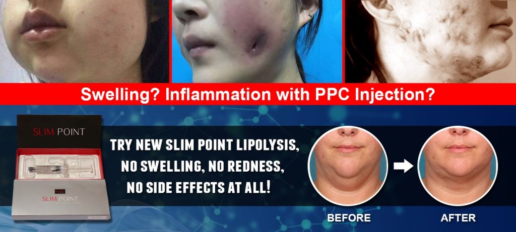 lipo lab ppc lipolysis injection